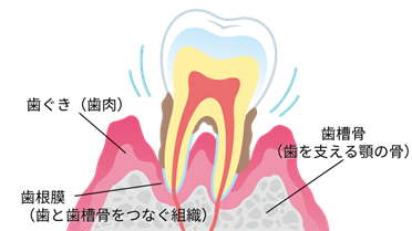 歯周病